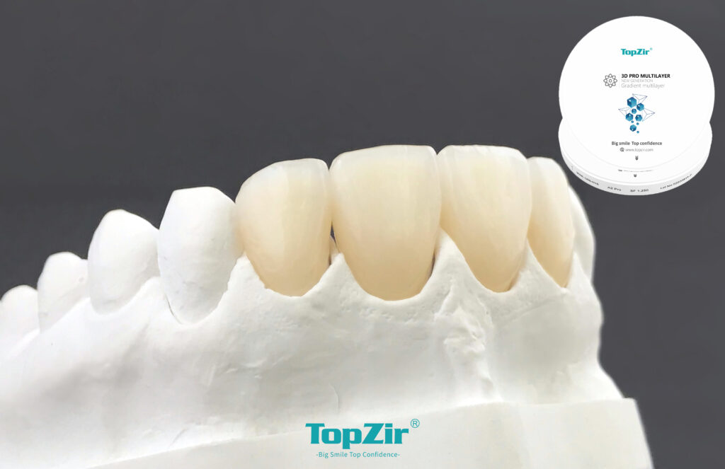 Flexible Dentures - 8