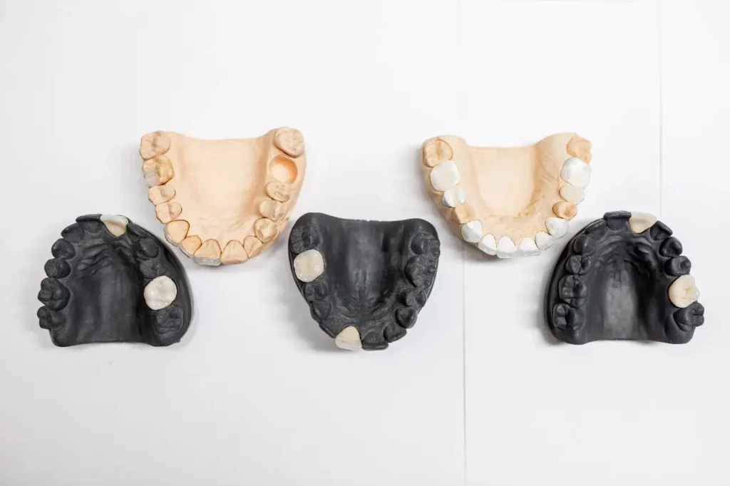 Flexible Dentures - 7