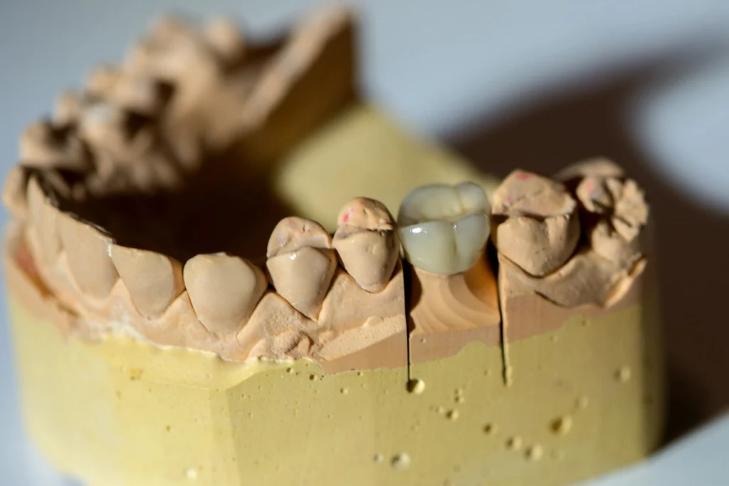 zirconia dental crown, zirconium oxide dental crowns