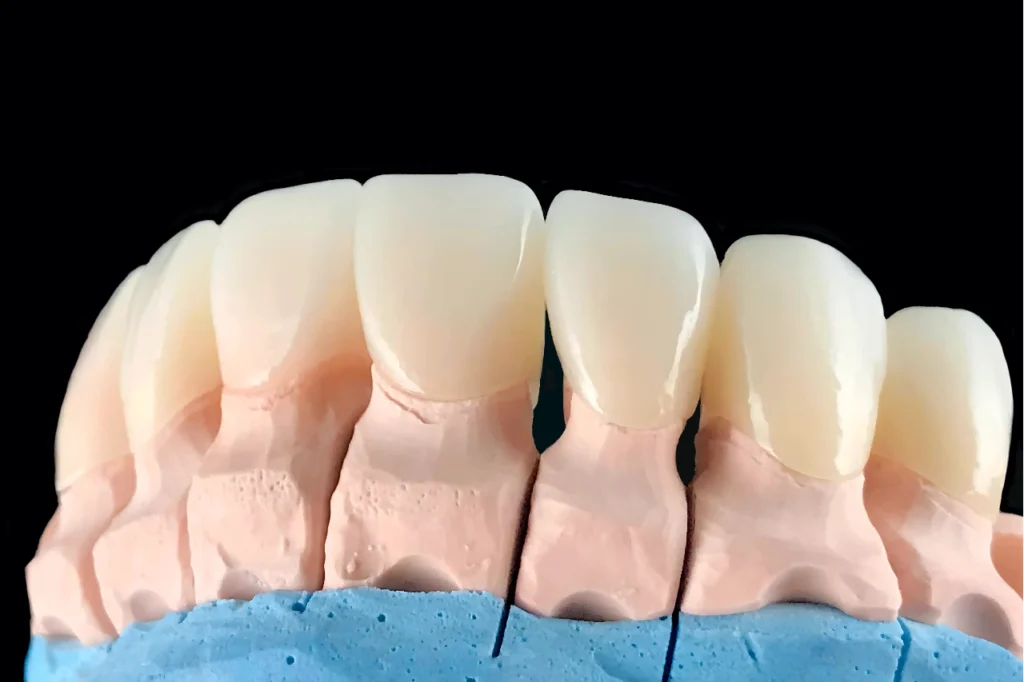 crown teeth zirconia