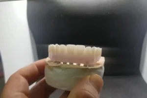 best zirconia blocks