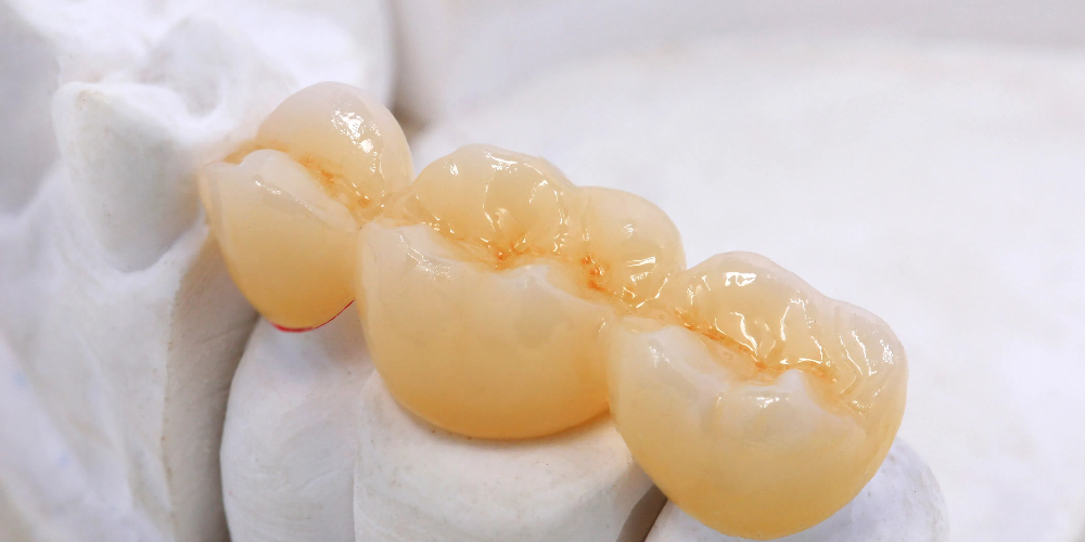 dental zirconia ceramic blocks