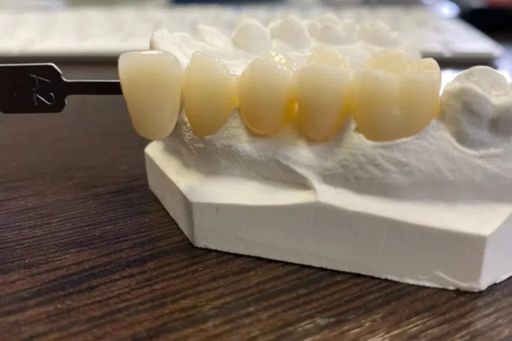 Monolithic Zirconia - 9