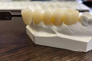 monolithic zirconia