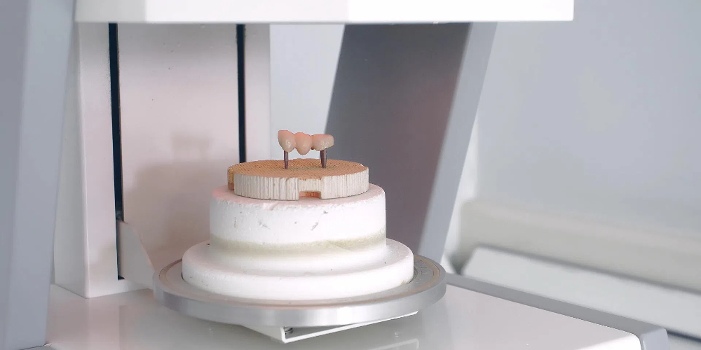 zirconia and porcelain crowns