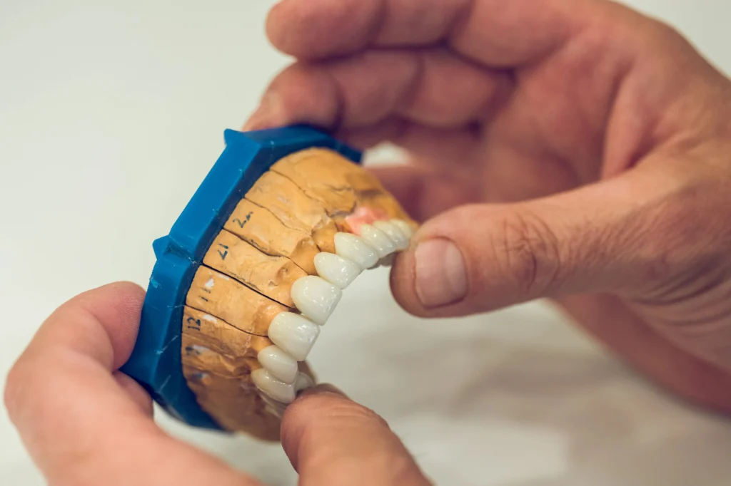 permanent zirconia teeth