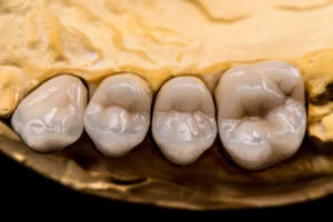 zirconia cad cam blocks