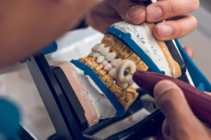 front teeth zirconia crowns