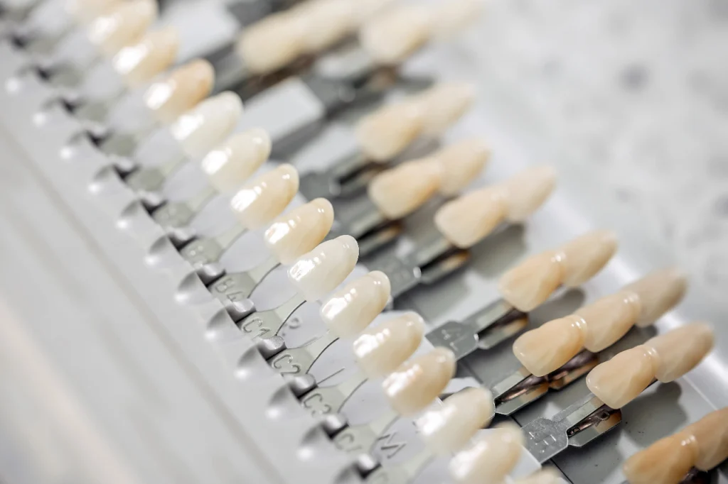 Monolithic Zirconia - 5