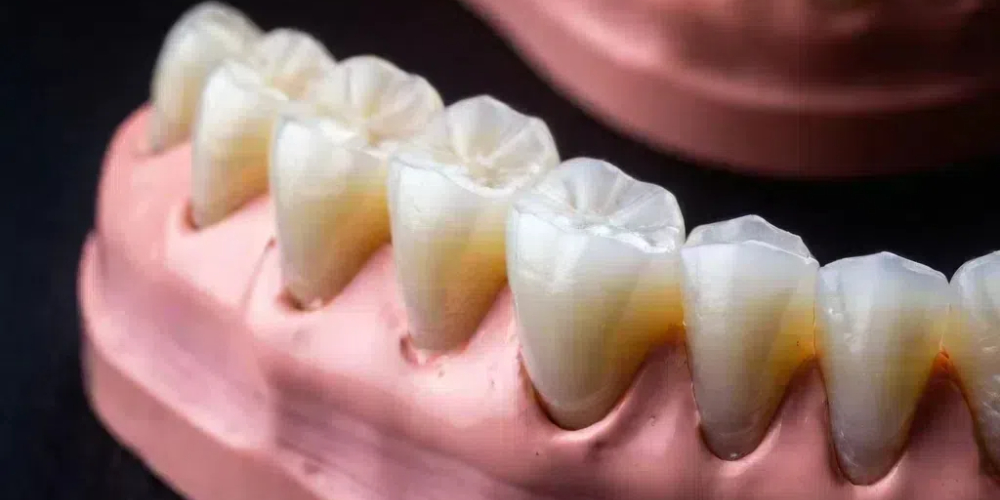 layered zirconia