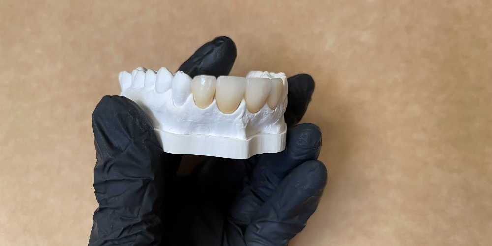 cubic zirconia crown