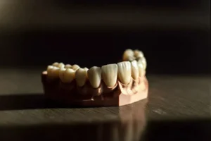 zirconia and porcelain crowns